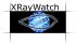 XRayWatch - Managed File Transfer